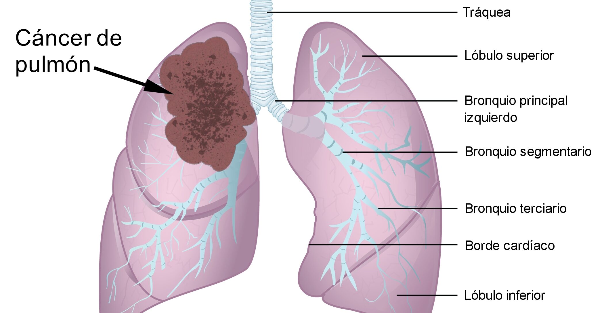 Cancer: symptoms, causes, treatment,and prevention